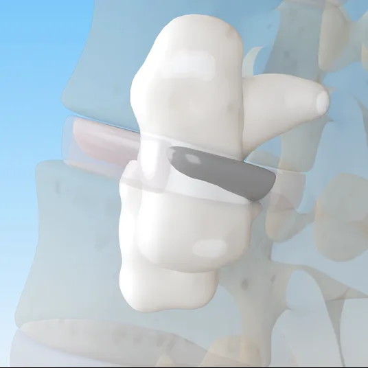 3D rendering of the lumbar spine