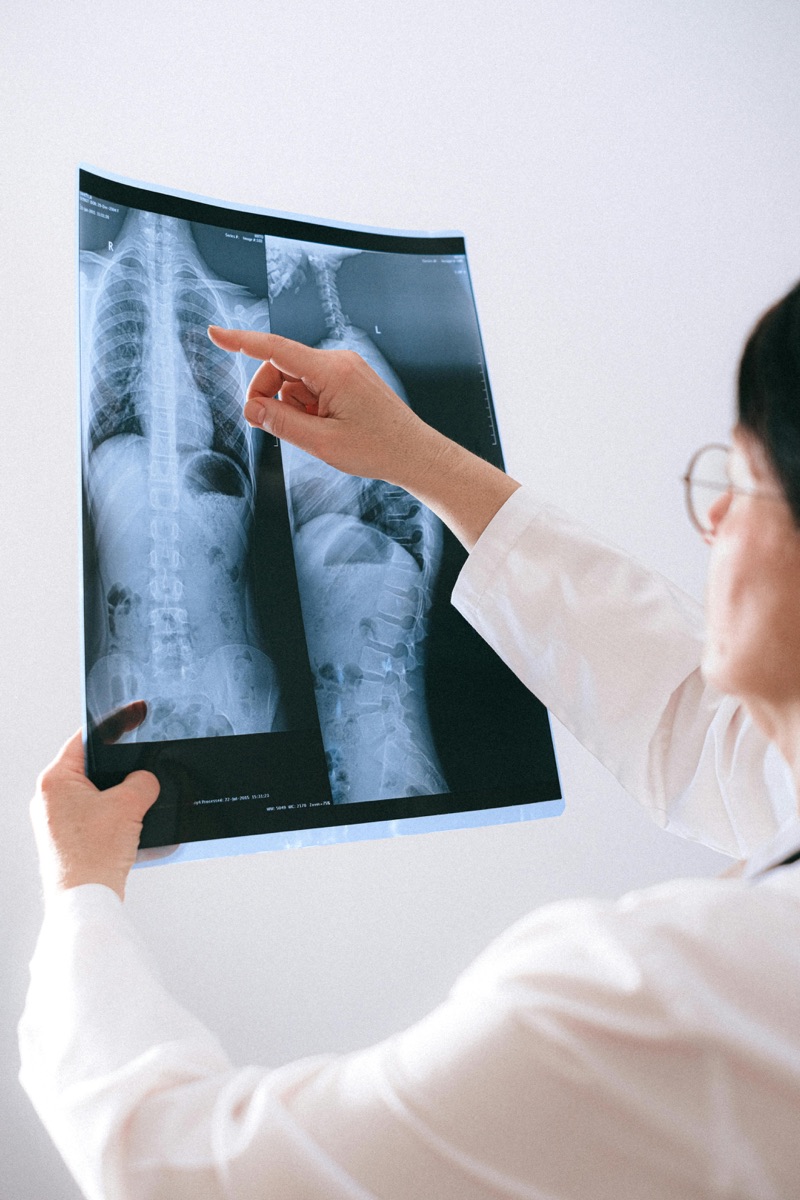 Spinal radiograph displayed in a clinical setting